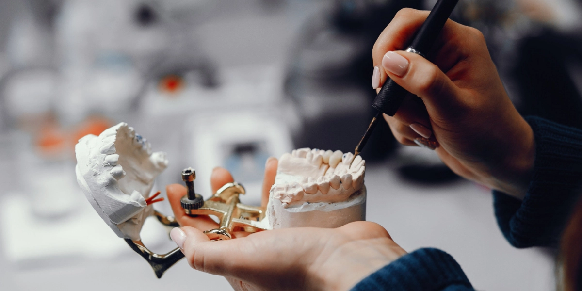 Blog 12 Dental Implants Hungary Helvetic Clinics